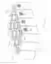 Fig. 06 - MEDICAMENT HOUSING APPARATUS HAVING OUTER AND INNER CONTAINERS