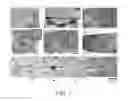 Fig. 02 - STEM CELLS THAT TRANSFORM TO BEATING CARDIOMYOCYTES