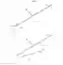 Fig. 02 - Endo-Loop For Endoscope Surgery