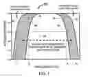 Fig. 07 - Baseline correction in systems for detecting ischemia