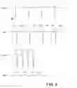 Fig. 08 - Baseline correction in systems for detecting ischemia