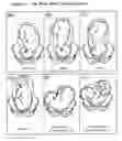 Fig. 02 - Fetal surveillance