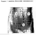 Fig. 08 - Fetal surveillance