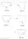 Fig. 06 - Biopsy needle system, biopsy needle and method for obtaining a tissue biopsy specimen