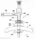 Fig. 01 - Balloon trocar