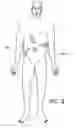 Fig. 03 - Balloon trocar