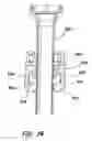 Fig. 28 - Balloon trocar
