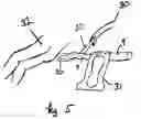 Fig. 06 - Absorbent article for use with an application aid