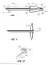 Fig. 02 - Occlusive cinching devices and methods of use