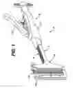 Fig. 02 - Linear stapler with improved firing mechanism
