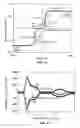 Fig. 09 - Read sensor stabilized by bidirectional anisotropy