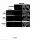 Fig. 09 - METHOD TO INDUCE RNAI IN PROKARYOTIC ORGANISMS