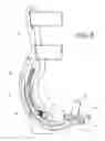 Fig. 07 - Ankle orthosis