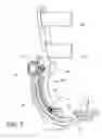 Fig. 08 - Ankle orthosis