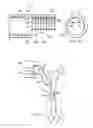 Fig. 06 - System for administering reduced pressure treatment having a manifold with a primary flow passage and a blockage prevention member