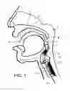 Fig. 02 - Method for predicting deposition of inhaled medicament at the lung