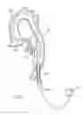 Fig. 02 - GUIDING CATHETER WITH CHEMICALLY SOFTENED DISTAL PORTION AND METHOD OF MAKING SAME
