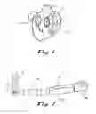 Fig. 02 - Apparatus and methods for cardiac ablation