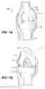 Fig. 02 - Arthroplasty devices and related methods
