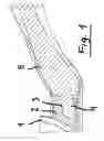 Fig. 02 - Tilting handle for pans