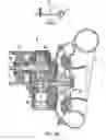 Fig. 02 - Supercharger