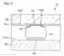Fig. 05 - Flip chip bonding structure