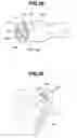 Fig. 27 - Endoscope insertion assisting device, endoscope apparatus, medical treatment device and endoscope insertion method