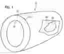 Fig. 02 - Method for imaging an infarction patient's myocardium and method for supporting a therapeutic intervention on the heart