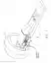 Fig. 02 - MRI biopsy device
