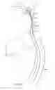 Fig. 10 - Coaxial catheter system