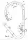 Fig. 02 - Apparatus and method for reducing cardiac valve regurgitation