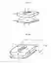 Fig. 02 - Artificial disc replacement using posterior approach