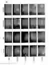 Fig. 02 - Osteogenic implant matrices and endosseous tooth implants with improved osteointegration properties