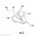 Fig. 06 - Tool for holding a bolt