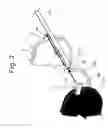 Fig. 03 - Interchangeable spectacles and clip-on assembly