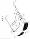 Fig. 04 - Interchangeable spectacles and clip-on assembly