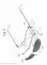 Fig. 06 - Interchangeable spectacles and clip-on assembly