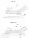 Fig. 08 - Stabilizer for in vivo examination