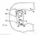 Fig. 01 - Plate-link chain, particularly for a motor vehicle drive system