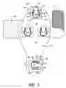 Fig. 02 - DVT prevention apparatus