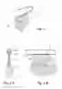 Fig. 04 - Catheters with Laterally Deployable Elements and Linear Ultrasound Arrays