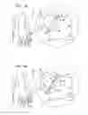 Fig. 04 - Method and system for lipolysis and body contouring