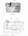 Fig. 04 - METHOD AND APPARATUS FOR SELECTIVE TREATMENT OF BIOLOGICAL TISSUE USING ULTRASOUND ENERGY