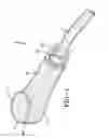 Fig. 02 - Shock Wave Treatment Device