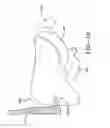 Fig. 13 - Shock Wave Treatment Device