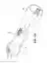 Fig. 19 - Shock Wave Treatment Device