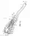 Fig. 20 - Shock Wave Treatment Device