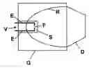 Fig. 01 - Device for generating shock waves