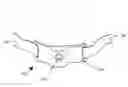 Fig. 01 - Adjustable tissue compression device