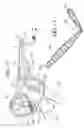 Fig. 06 - Orthopedic brace